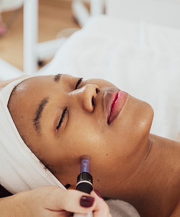 Woman receiving facial treatment with microneedling.